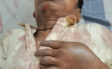 तेज रफ्तार चारपहिया की टक्कर से साइकिल सवार अधेड़ गंभीर घायल