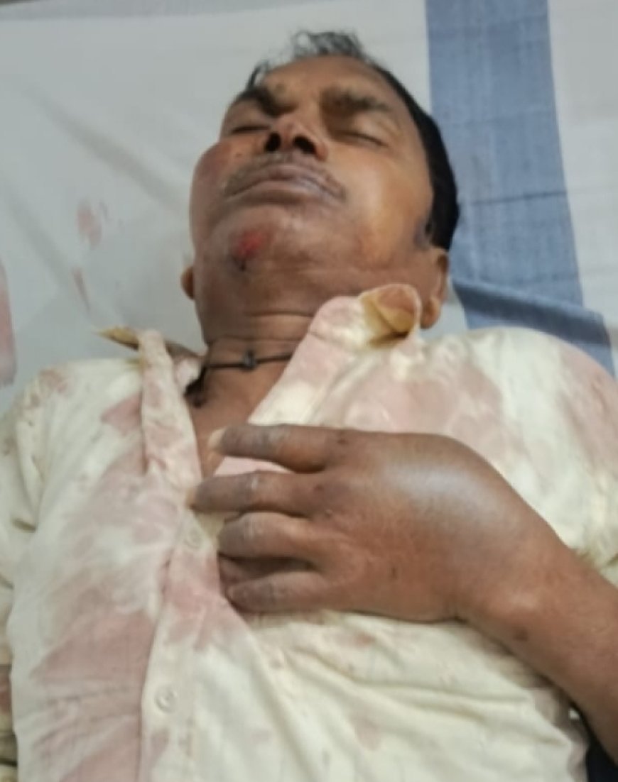 तेज रफ्तार चारपहिया की टक्कर से साइकिल सवार अधेड़ गंभीर घायल