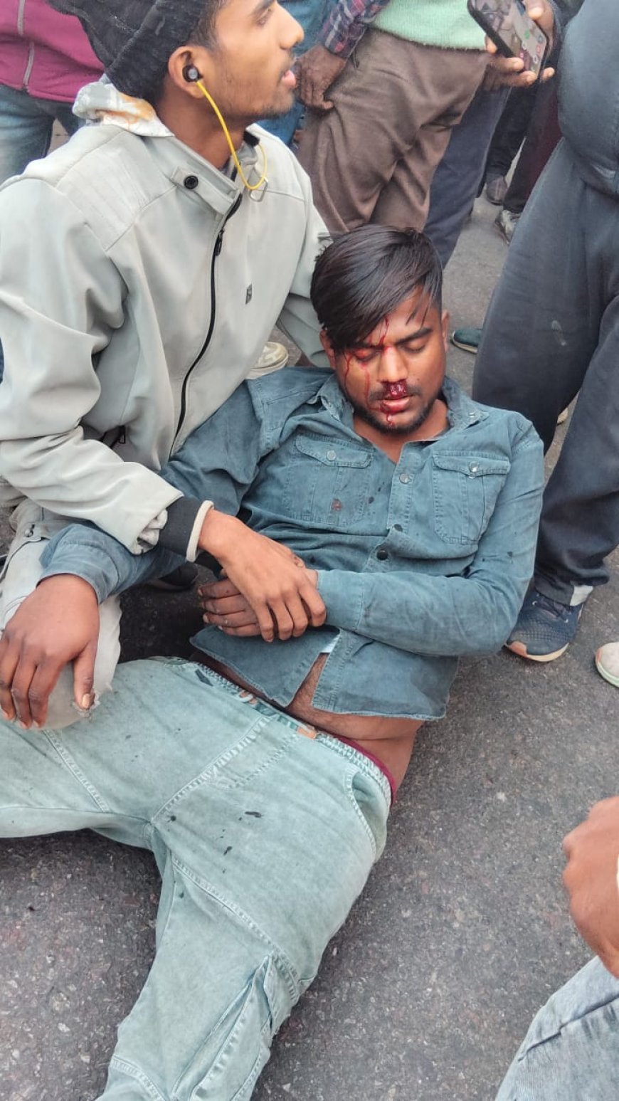 रामकोला ट्रक-बाइक भिड़ंत में दो युवक घायलः रामकोला-कप्तानगंज रोड पर हादसा, चालक फरार