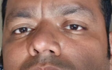 चाइनीज मांझे का कहर: बुलेट सवार कारोबारी का चेहरा कटा, सड़क पर गिरकर गंभीर घायल; गाल पर लगे 8 टांके